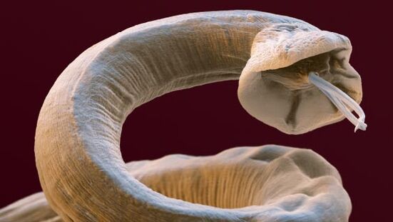 Parasites à l'intérieur d'une personne