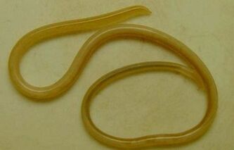 types de parasites dans le corps humain