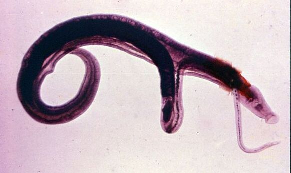 Les schistosomes sont l'un des parasites les plus courants et les plus dangereux